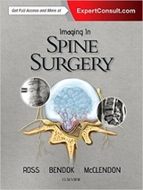 Imaging in Spine Surgery, 1e