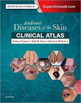 Andrews’ Diseases of the Skin Clinical Atlas, 1e